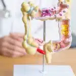 Facteurs de risques et traitements du cancer de l'anus